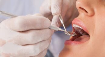 In pochi lo sanno ma tutti questi interventi dal dentista sono gratis: come verificarlo subito